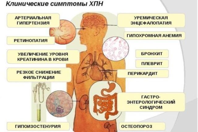 Порфириновая гемофилия обливион как вылечить